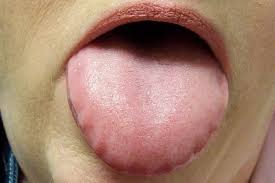 Tu lengua y tu salud
